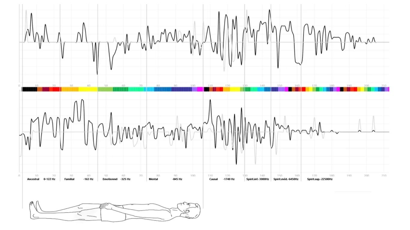 renacercr369 CLÍNICA DE BIENESTAR Y BIORRESONANCIA CUÁNTICA COSTA RICA5