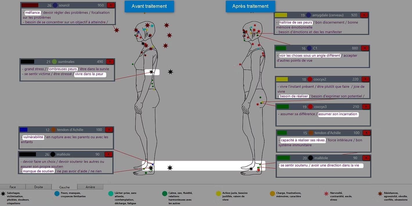 Soin_harmonisation_exemple-min